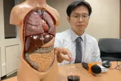 上廁所拉整缸「深紅色葡萄酒」血管增生血紅素剩一半！ 醫點出長期風險