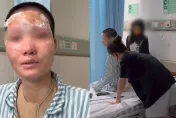 影/夫家以意外燒傷募得千萬善款　毀容妻怒控「詐捐」：丈夫潑汽油抱我輕生