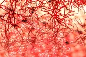 38歲女腹瀉檢查出「脊椎血管瘤」壓迫神經險癱瘓　醫：非常罕見！第一次見到