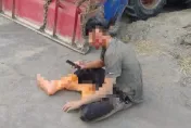 被當壞人還縫17針！彰化少年毀容也不恨　立志從警不改變