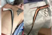 海灘玩水魟魚毒刺竟扎進身體！　美國女爆痛直呼：「我要死了」