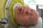 男子患小兒麻痺無法自主呼吸　躺6百磅鐵肺中生活70年
