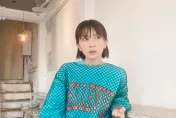 日本女星罹患「白斑症」不敢見人！醫曝僅有「1-2%的人」會得到