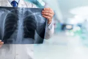 20多歲女罹肺腺癌！醫基因檢查發現：4大原因誘發