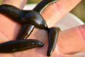 6旬婦不明原因咳半個月還帶血！赴醫發現「8公分水蛭」在氣管內