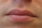 冬天嘴唇乾裂擦護唇膏沒用？皮膚醫糾NG保養：塗「這個」最有效