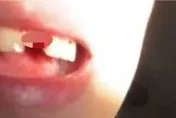 女子打瞌睡躺著玩手機⋯下秒滿口鮮血　半顆門牙竟被砸斷