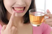 牙齒怎麼刷都黃黃的？常喝「這4種飲品」恐害牙齒炸黃　茶、咖啡都上榜