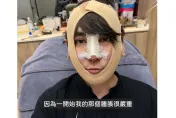 志祺七七變身韓系歐巴！公開整形部位　曝動刀後「雙親超崩潰」以為失敗
