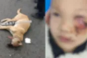 影/心疼！8歲男童買早餐遭狗撲咬近毀容　媽媽心碎：臉上縫了90多針