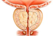 73歲老台商「攝護腺肥大」忍8年拖成癌！醫一看：腫瘤已穿透攝護腺