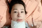 兵家綺切除甲狀腺驚見「淋巴有癌」！醫揭初期「6大徵兆」別輕忽