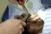 女子車禍！頭上「鯊魚夾」插進頭皮　用「鉗子」才拔出來