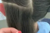 美髮師生涯最大挑戰？她幫女孩清頭皮　「一梳上百顆蟲卵」當場嚇傻