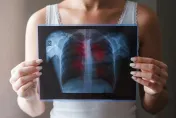 新冠疫情捲土重來！10個肺炎住院「半數因新冠」高齡共病者別大意