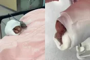 影/吃完宵夜莫名遭砍！新竹男慘被「斷指、腳筋露出」　妙齡女嚷：砍錯人了