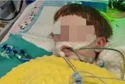 5歲童拔2顆乳牙竟釀腦死！父親崩潰指控醫生「強迫戴麻醉面罩」