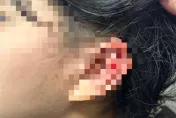 急尋目擊者！三峽少女遭橋下「向上射」沖天炮炸破耳膜　家屬發文緝「兇」