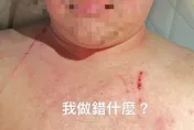 林千又控家暴疑反轉！賴姓富商抓痕傷勢曝光…悲喊：我做錯什麼