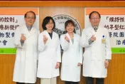幼年「紅斑性狼瘡」治療新發現！　台大研究7年「這療法」降死亡風險