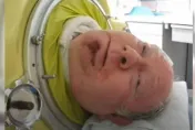 6歲患小兒麻痺「困鐵肺70年」還當上律師　美國傳奇男逝世享壽78歲