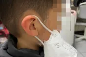 孩子上學遭強硬「貼」口罩！臉頰現兩紅斑　母心疼問：一定要戴？