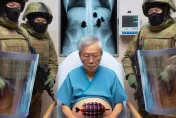 塞椰子不是極限！阿公跟一戰未爆彈「肛肛好」　驚動拆彈部隊封鎖醫院