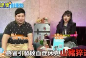 影/生日前夕過世  山豬曾自述與「紅斑性狼瘡」和平相處  6個關鍵照顧法則曝光