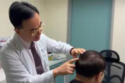 男頭皮長「詭異腫瘤」長期咳嗽、聲音沙啞！醫一看驚「是肺癌轉移」
