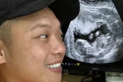 快訊/《瘋神無雙》阿虎宣布當爸！曬超音波照笑喊：我們都沒有頭髮