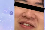 手殘傳男友露齒近照！LINE官方帳號無法收回　管理員義氣相挺不外流