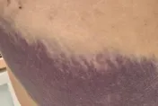 陳菁徽臀腰大片瘀青險沒命！台北律師公會還護航？羅智強轟：誰丟第一顆石頭