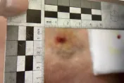 影/北市街頭女子無故遭BB彈攻擊？　警：未發現可疑物品持續追查