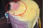 吃冰淇淋咬到硬塊！　印度醫一吐驚見「人類手指」：以為是堅果