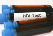 替HIV傷者發聲！藥師揭「U=U」感染力微乎其微