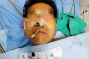 太可怕！一家4口誤食「毒菇」1人身亡　3人送進ICU