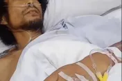 瘦成皮包骨！陸百萬網紅「麵筋哥」驚傳肝癌晚期　家人曝：已下病危通知