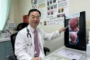 影/驚！69歲男服用標靶藥物「頭皮整片潰爛」　醫：最嚴重等級併發症