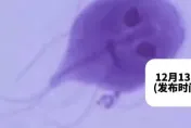 陸男瘋狂腹瀉2週！糞便中驚見「鬼臉」　疑寵物感染寄生蟲