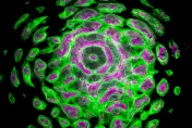 「甘露糖」助膀胱癌細胞自毀！醫：蘋果、橘子含量多