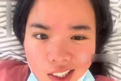 陸妙齡女吹電扇睡覺…醒來竟「嘴歪眼斜」　醫示警「1族群」