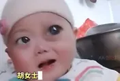 影/陸男嬰罹罕病眼睛「腫如燈泡」　父不願養狠心離婚