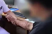 陸青少年瘋吸打火機「丁烷」…引爆燒傷「手指伸不直」痛哭悔