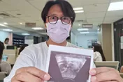 張啟樂當爸了！曬超音波照　嗨喊愛妻懷孕是「意外驚喜」
