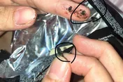 一口咬下崩潰！名牌雪糕吃到「一坨惡臭黑毛」　業者：已啟動調查