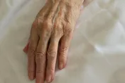 求善終！南韓逾320萬人登記「尊嚴死」　女性長者佔多數