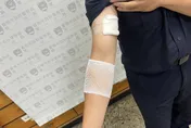 台南所長追行車糾紛嫌犯　竟遭對方持榔頭攻擊、咬傷手臂