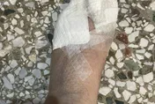 花蓮光復大安村長救災重傷　10腳趾「磨破皮快見骨」