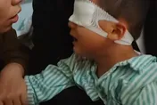 影/扯！5歲陸童遭同學戳傷眼球　幼師「塗豬油」致感染失明