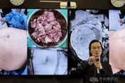 女罹子宮肌瘤「肚大如懷孕」！微創擺脫痛又醜困擾